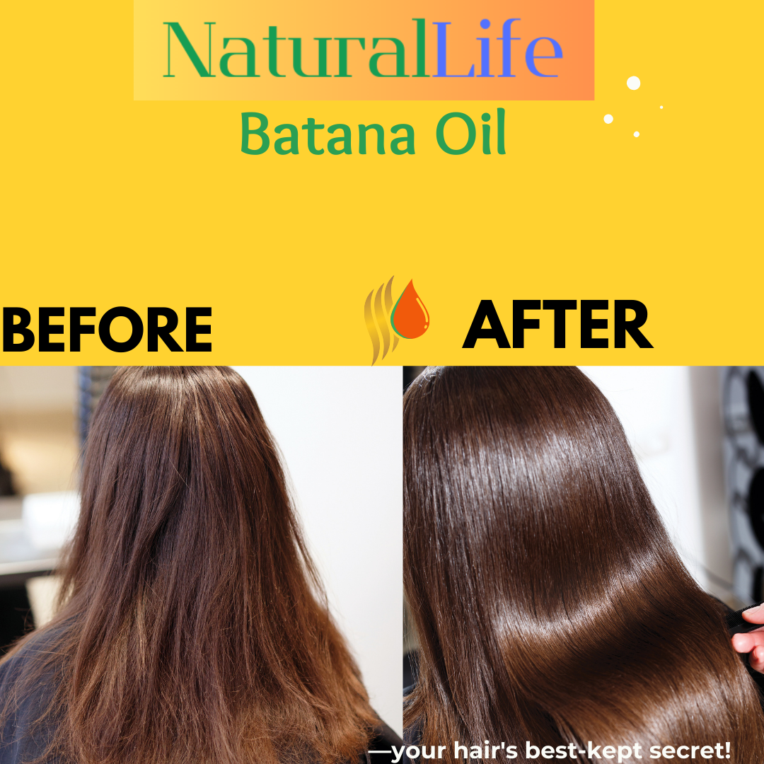 NaturalLife Cold Pressed Batana Oil with Pipette - Pure & Easy to Apply