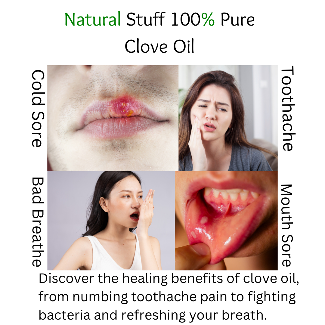 Natural Stuff Clove Oil - Pure, Therapeutic Grade 10ml