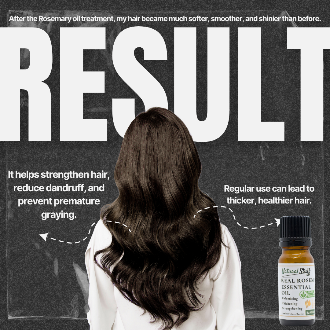 Natural Stuff 100% Real Rosemary Essential Oil 10ml - Smell the Difference